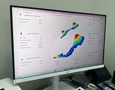 Диагностика стопы